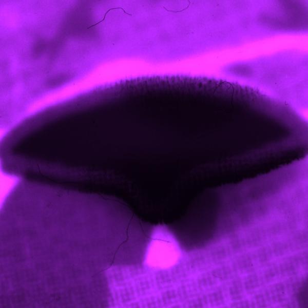 "the tender place where the world breaks" still, 16mm film, super 8mm film, regular 8mm film, bandaids