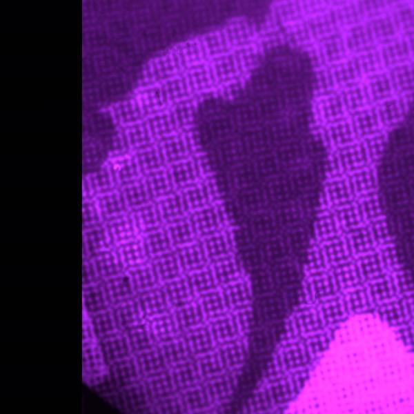 "the tender place where the world breaks" still, 16mm film, super 8mm film, regular 8mm film, bandaids