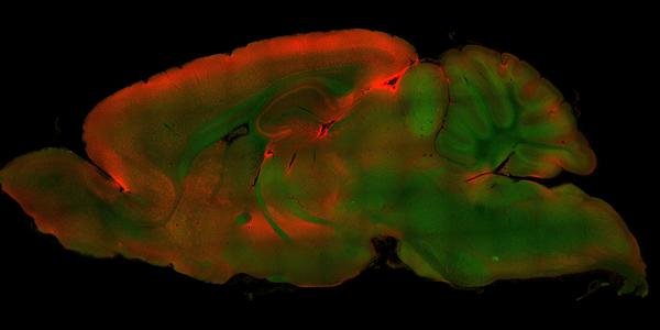 stained brain image