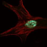 A cardiomyocyte imaged by the BioFrontiers Advanced Imaging Facility.