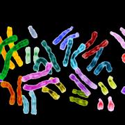 Telomeres sit at the ends of chromosomes to protect their genetic data. Credit: Jane Ades, NHGRI