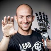 Jacob Sigel with prosthetic hand