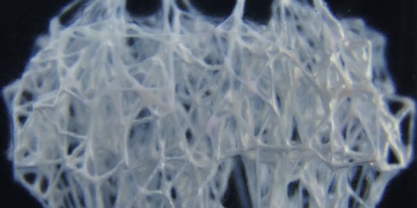 A network of capillaries 3D-printed using a newly developed technique. 