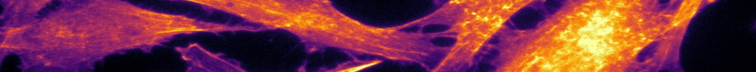 Fluorescently Labeled Actin Filaments.