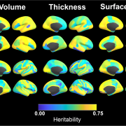 Regional heritability maps for cortical volume, thickness, and surface area. Results using the Desikan-Killiany and Destrieux anatomic parcellations are both provided