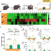 Experimental design for optical silencing of IPN GAD2+ neurons