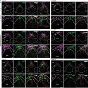 VTADA neurons from the PN send projections to the IPN
