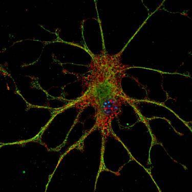 100x confocal IL1R1 neuron