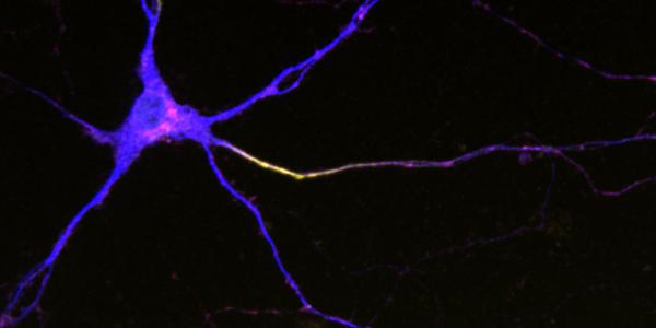 Image of neuron.