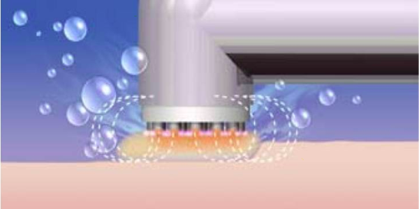 Modeling Heat Transfer in Biological Tissues