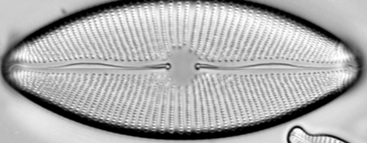 Diatom shaped like an eye under the microscope