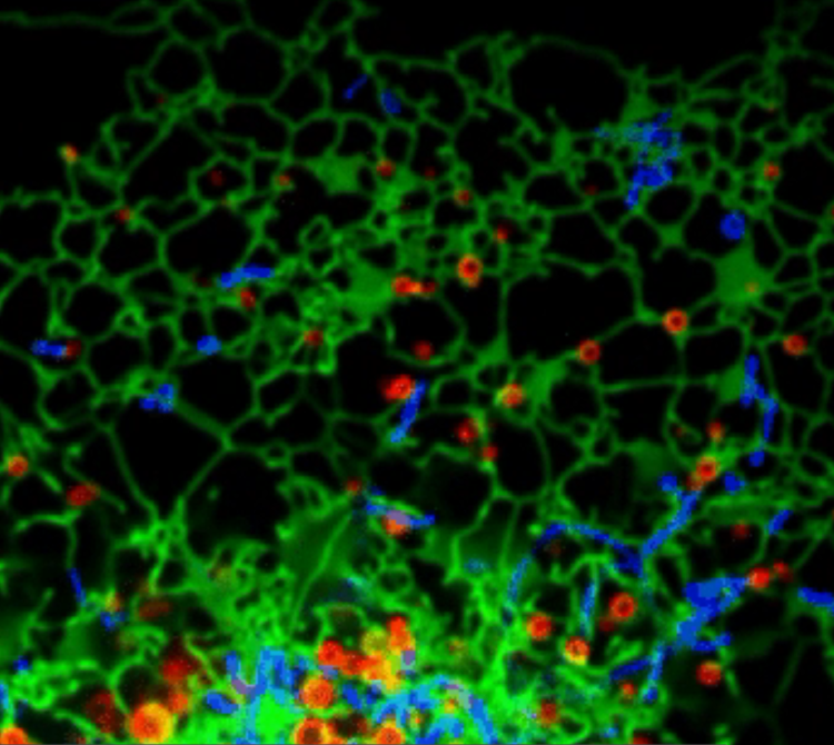 Endoplasmic reticulum 