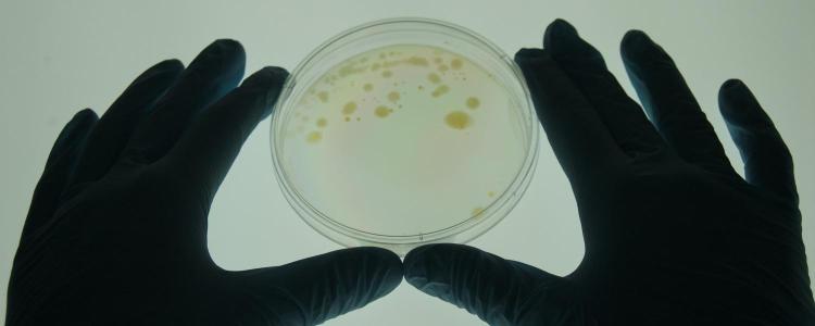 Mycobacterium Vaccae in a petri dish