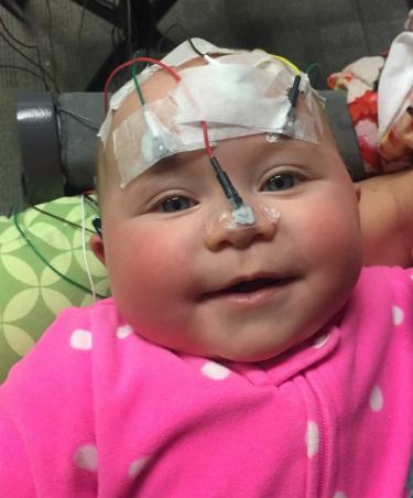baby with electrodes on her head