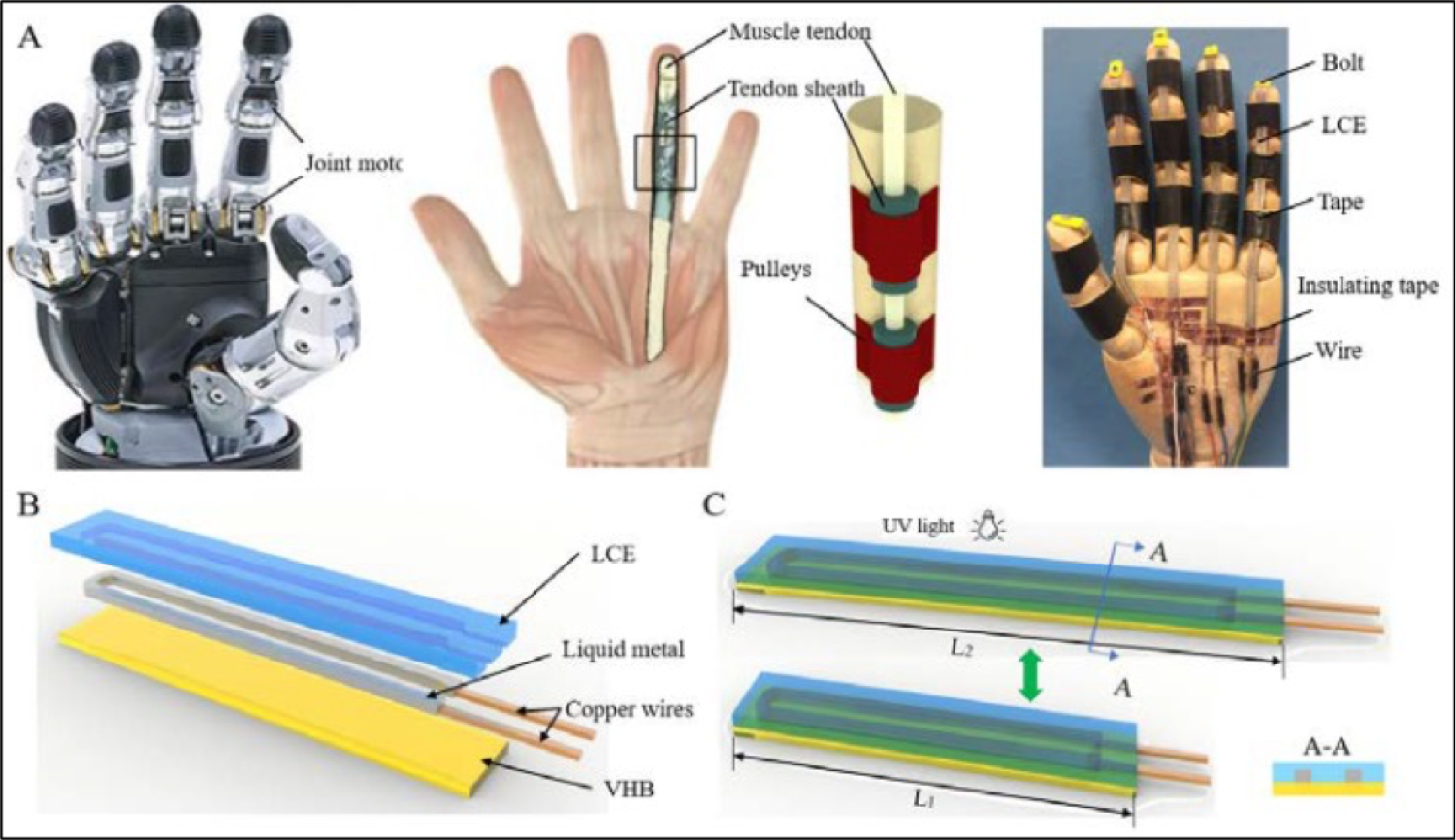 prosthetic hand diagram
